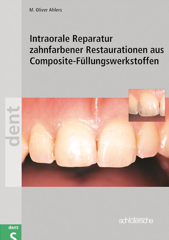 Intraorale Reparatur zahnfarbener Restaurationen aus Composite-Füllungswerkstoffen