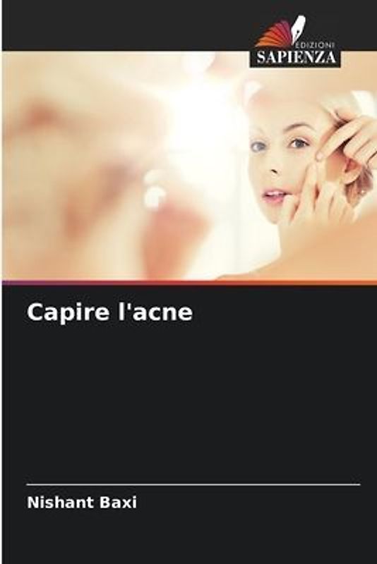 Capire l'acne