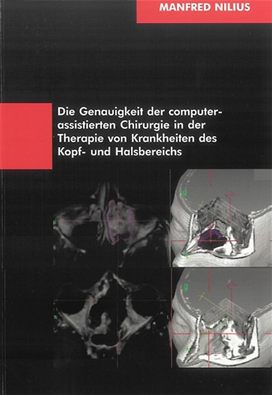 Die Genauigkeit der computerassistierten Chirurgie in der Therapie von Krankheiten des Kopf- und Halsbereichs