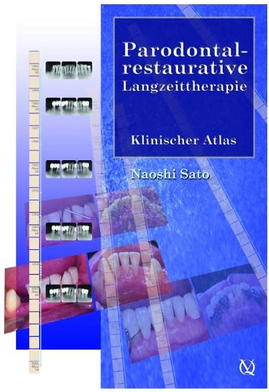 Parodontal-restaurative Langzeittherapie