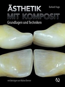 Ästhetik mit Komposit