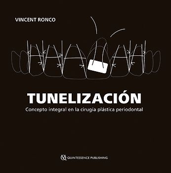 Tunelización