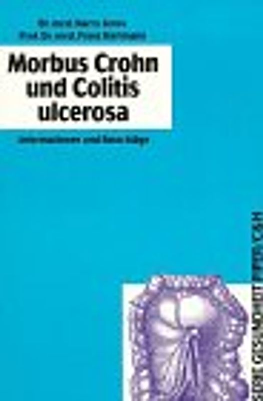 Morbus Crohn und Colitis ulcerosa. Informationen und Ratschläge