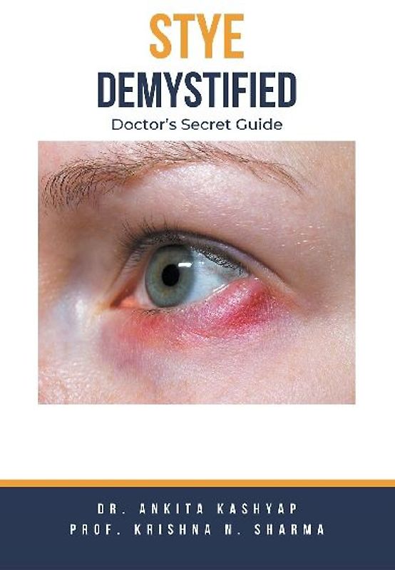Stye Demystified
