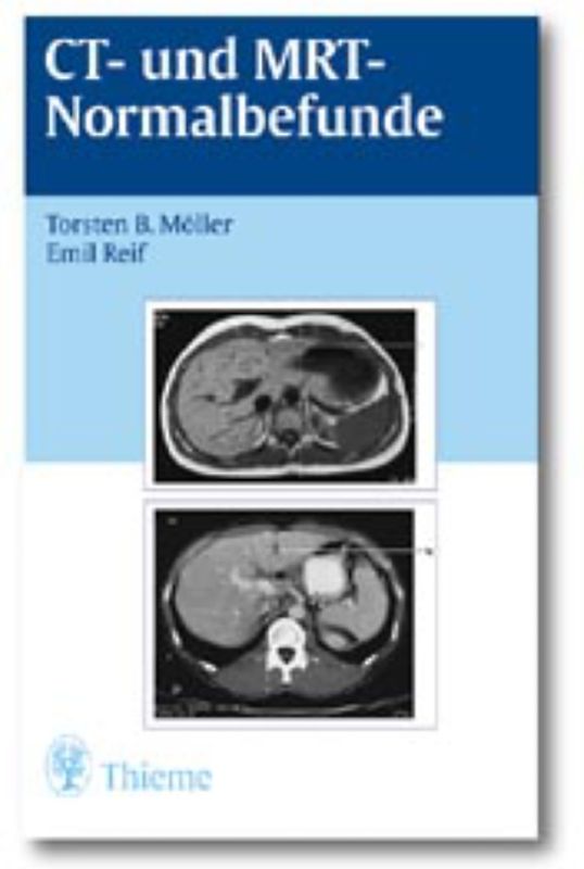 CT und MRT Normalbefunde
