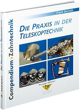 Die Praxis in der Teleskoptechnik