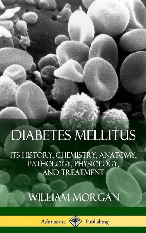 Diabetes Mellitus