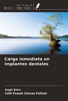 Carga inmediata en implantes dentales