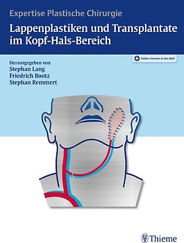 Lappenplastiken und Transplantate im Kopf-Hals-Bereich