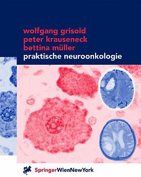 Praktische Neuroonkologie