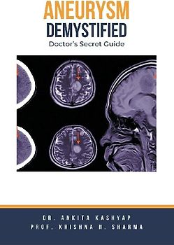 Aneurysm Demystified