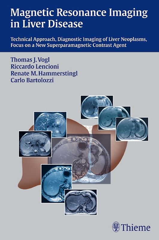 Magnetic Resonance Imaging in Liver Disease