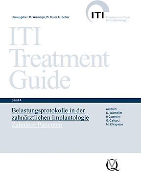 Belastungsprotokolle in der zahnärztlichen Implantologie