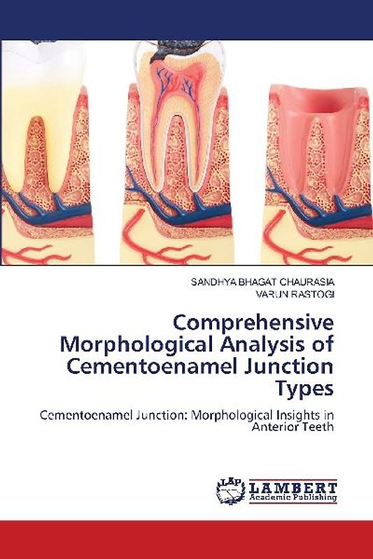 Comprehensive Morphological Analysis of Cementoenamel Junction Types