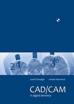 CAD/CAM in digital dentistry
