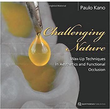 Challenging Nature: Wax-Up Techniques in Aesthetics and Functional Occlusion