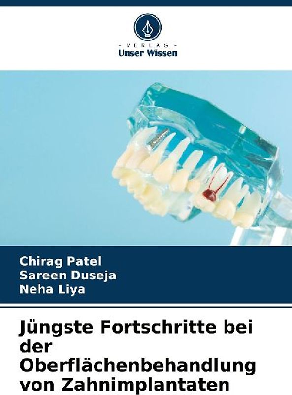 Jüngste Fortschritte bei der Oberflächenbehandlung von Zahnimplantaten
