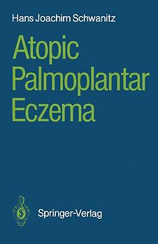 Atopic Palmoplantar Eczema