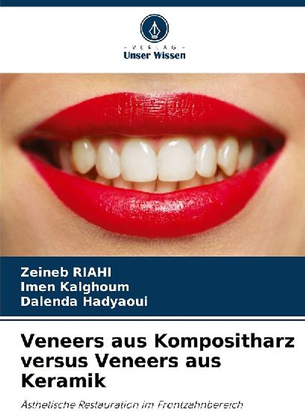 Veneers aus Kompositharz versus Veneers aus Keramik
