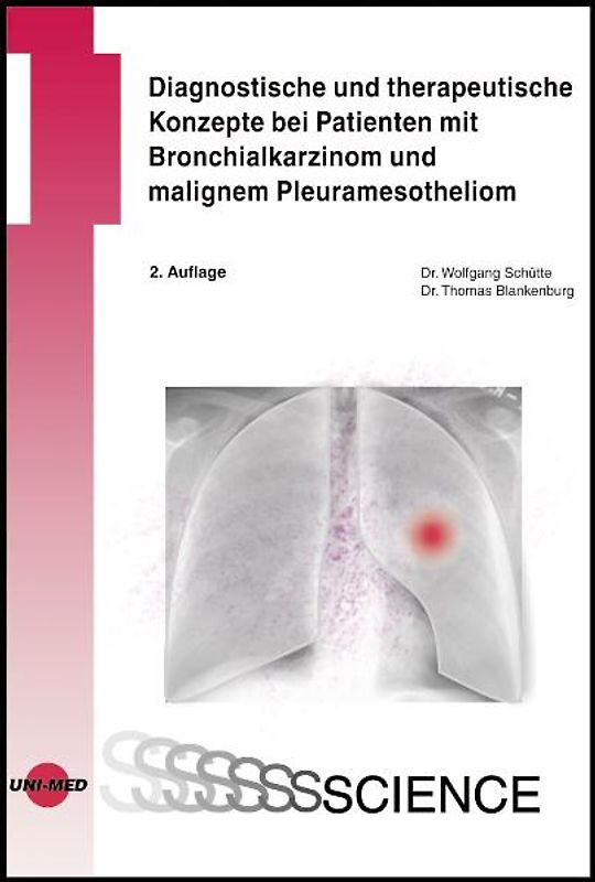 Diagnostische und therapeutische Konzepte bei Patienten mit Bronchialkarzinom und malignem Pleuramesotheliom