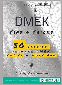 DMEK Tips & Tricks: 50 tactics to make DMEK easier and more fun