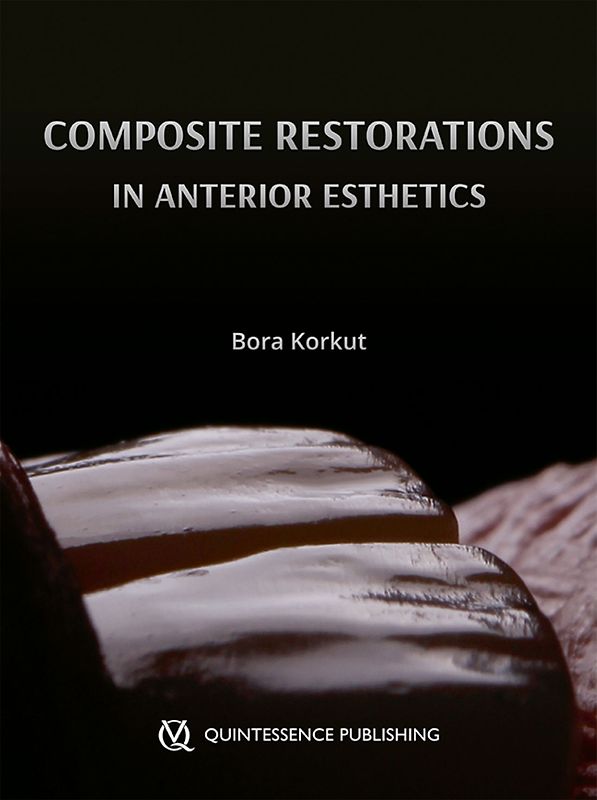 Esthetic Anterior Composite Restorations