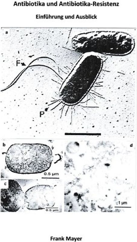Antibiotika und Antibiotika-Resistenz