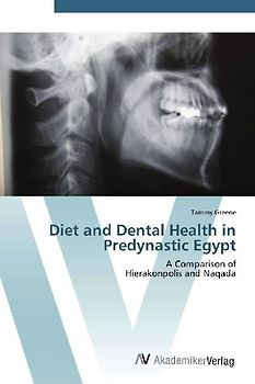 Diet and Dental Health in Predynastic Egypt