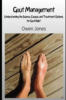 Gout Management: Understanding the Science, Causes, and Treatment Options for Gout Relief (How to...)