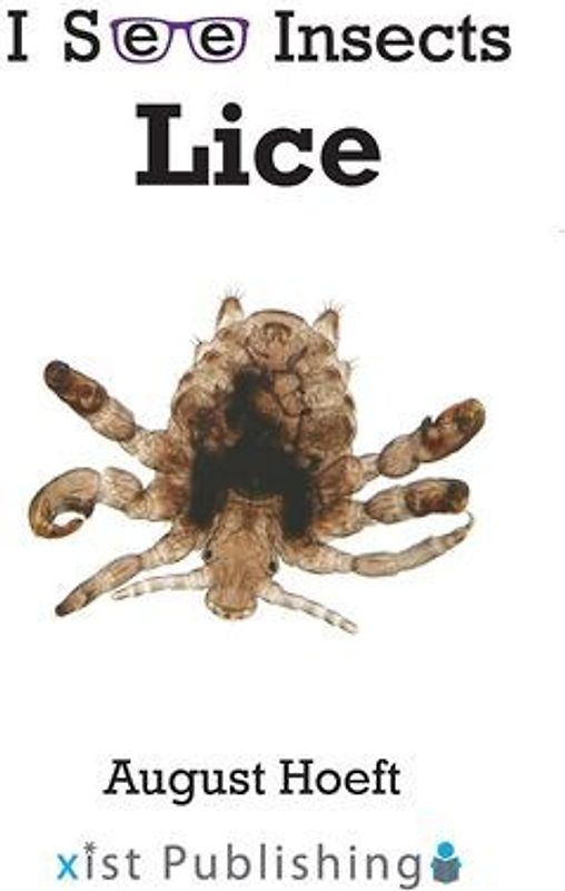 Lice