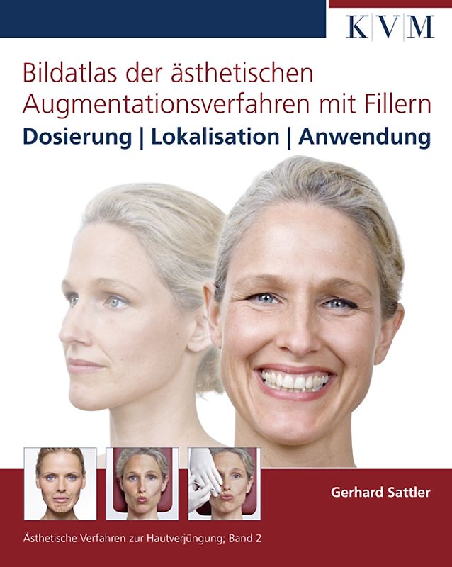 Bildatlas der ästhetischen Augmentationsverfahren mit Fillern