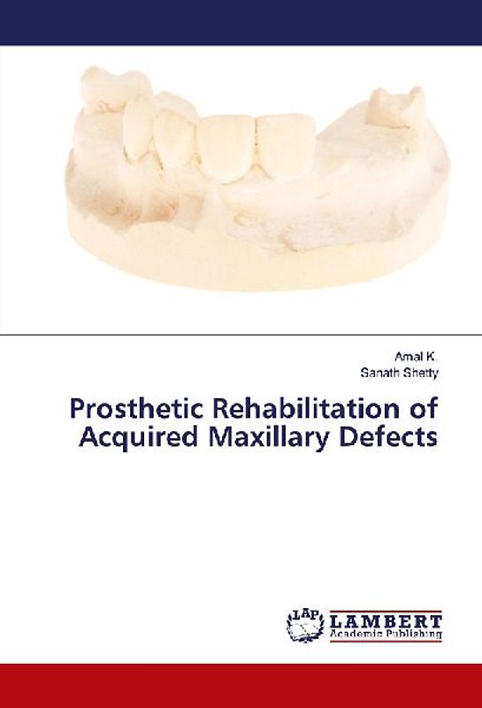 Prosthetic Rehabilitation of Acquired Maxillary Defects