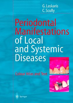 Periodontal Manifestations of Local and Systemic Diseases