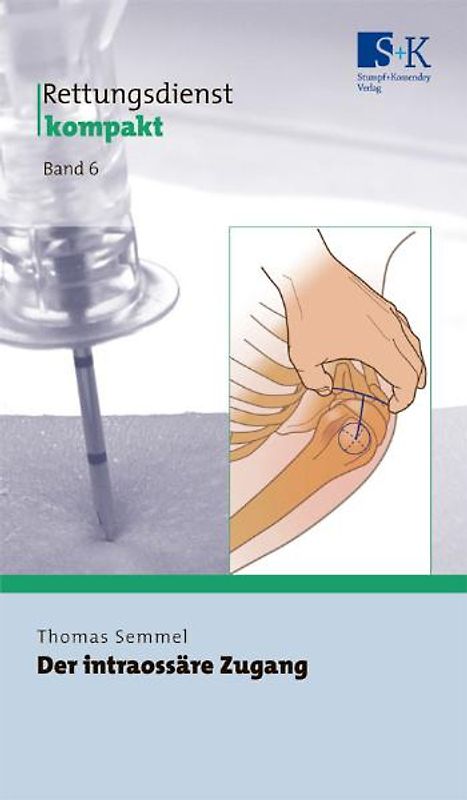 Der intraossäre Zugang