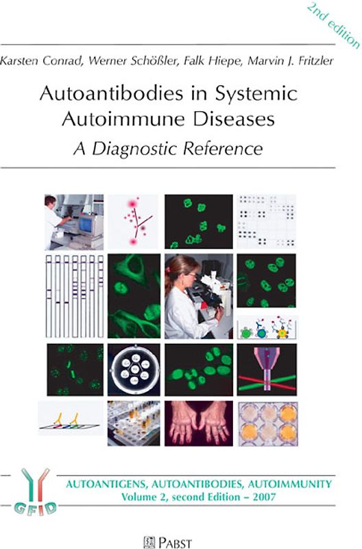 Autoantibodies in Systemic Autoimmune Diseases
