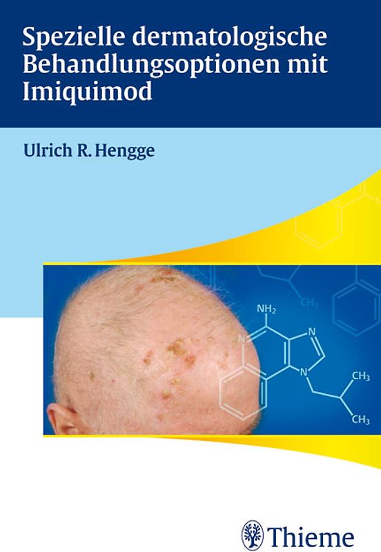 Spezielle dermatologische Behandlungsoptionen mit Imiqimod