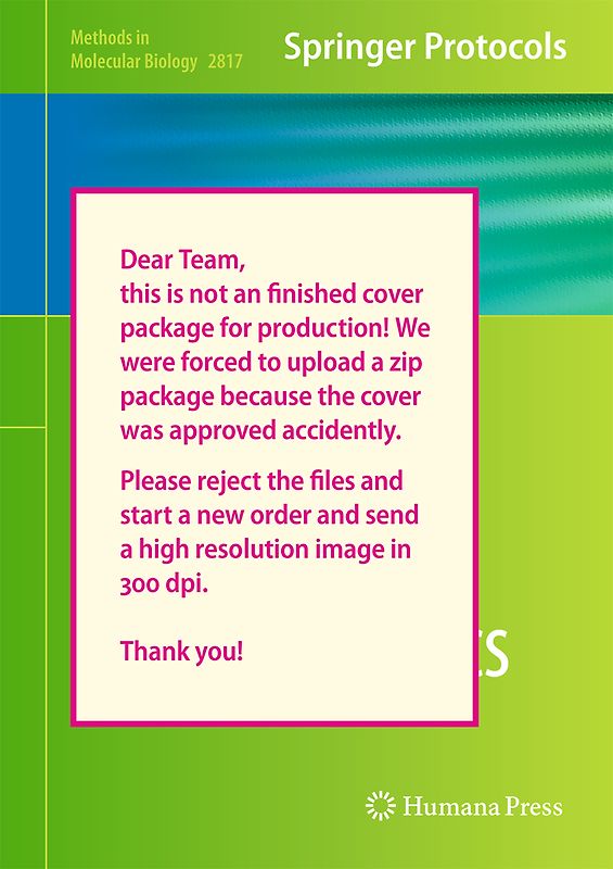 Mass Spectrometry Based Single Cell Proteomics