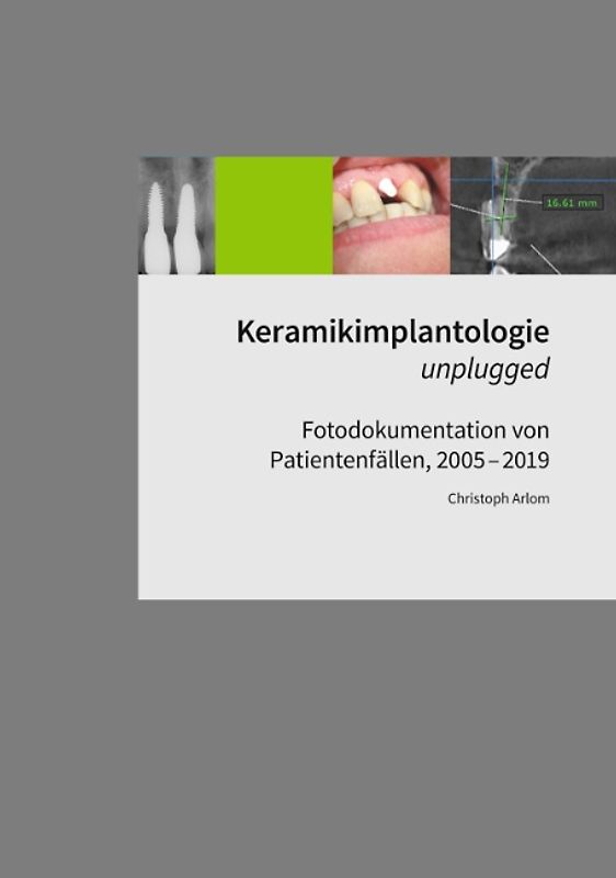 Keramikimplantologie unplugged
