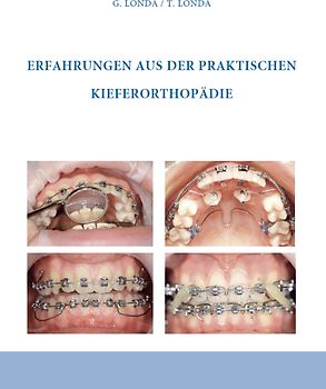 Erfahrungen aus der praktischen Kieferorthopädie