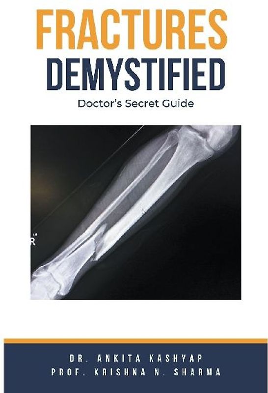 Fractures Demystified