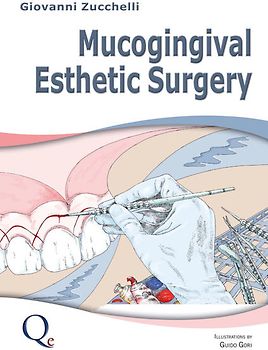 Mucogingival Esthetic Surgery
