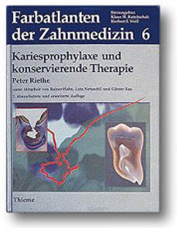 Band 6: Kariesprophylaxe und konservierende Therapie