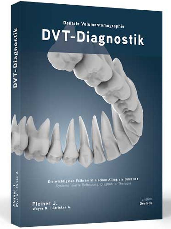 DVT-Diagnostik