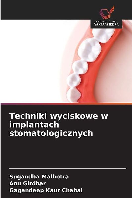 Techniki wyciskowe w implantach stomatologicznych