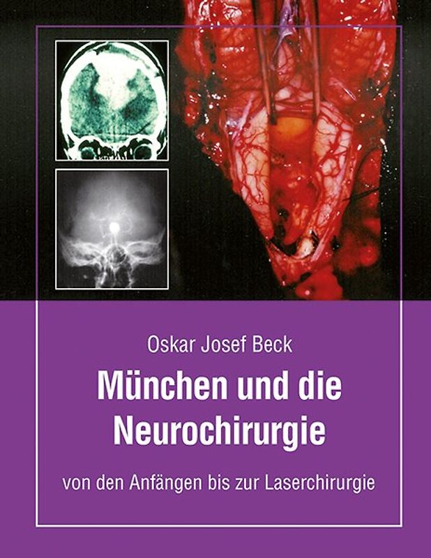 München und die Neurochirurige