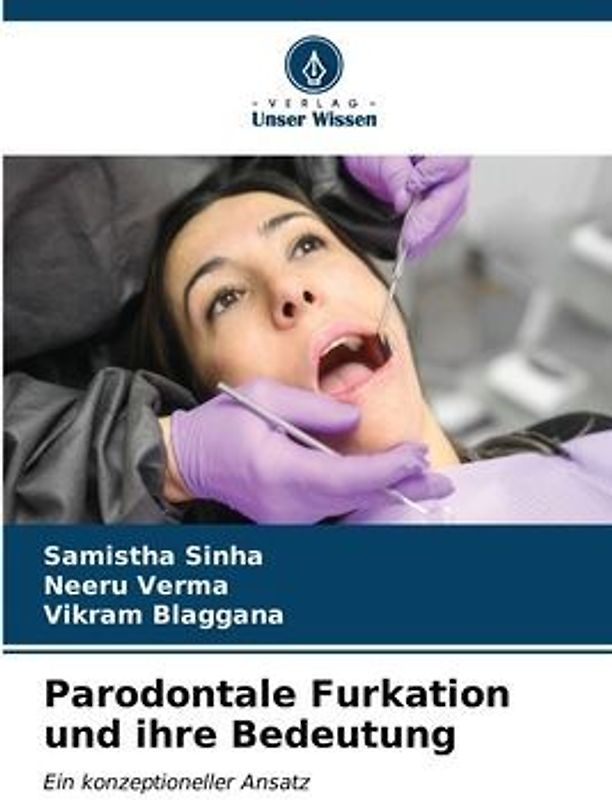 Parodontale Furkation und ihre Bedeutung