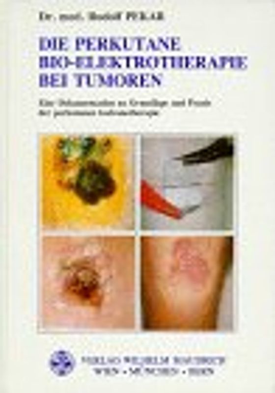 Die perkutane Bioelektrotherapie bei Tumoren