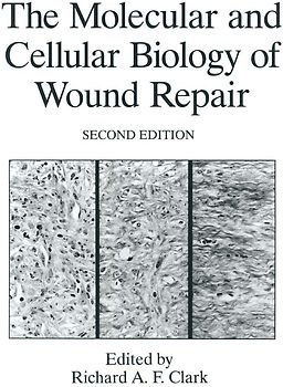 The Molecular and Cellular Biology of Wound Repair