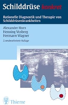 Schilddrüse konkret