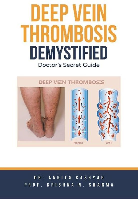 Deep Vein Thrombosis Demystified